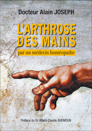 arthrose des mains 